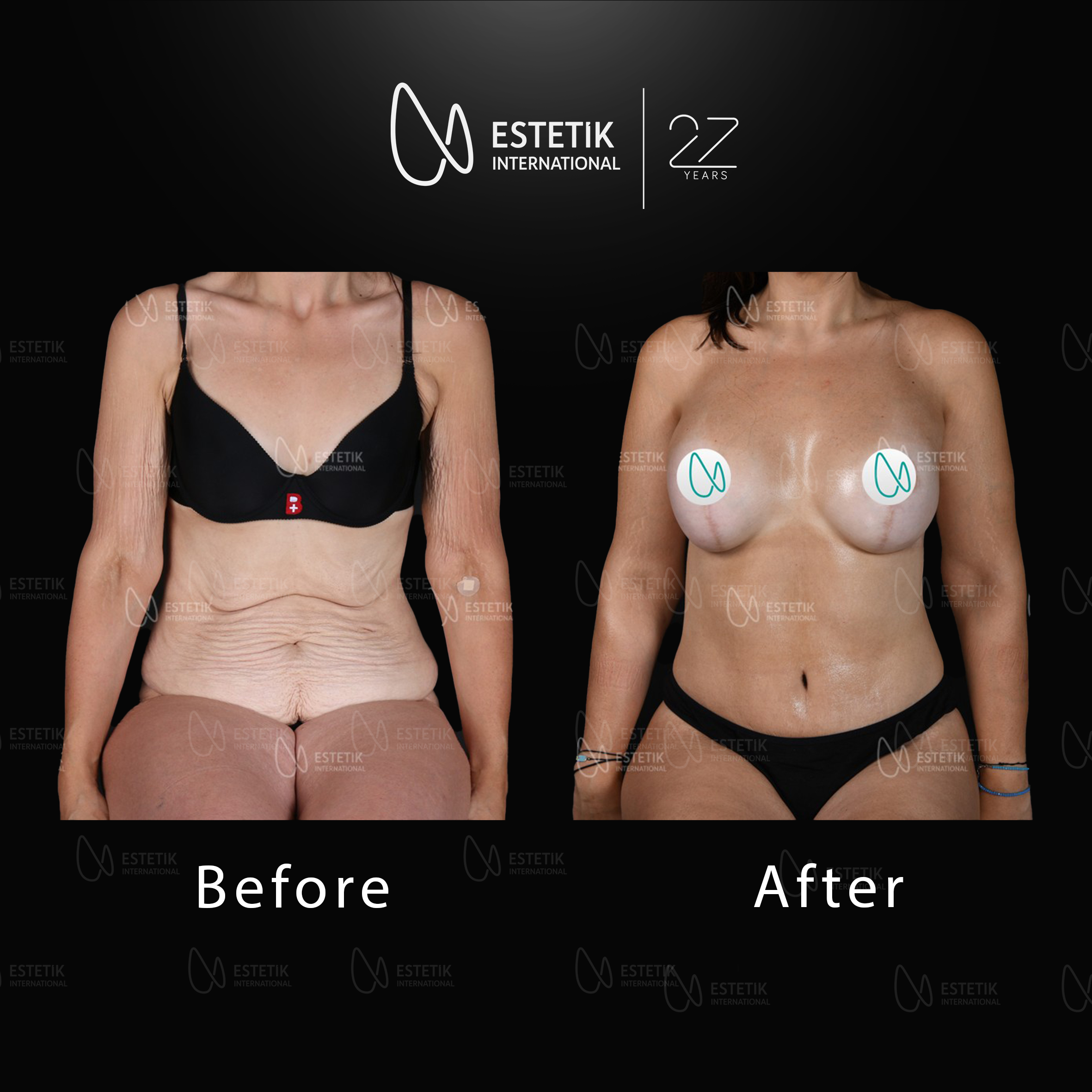 MOMMY MAKEOVER 9.jpg